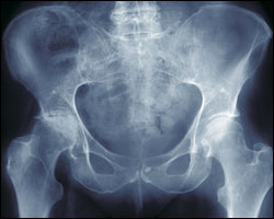 X-ray