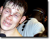 Forrest Griffin